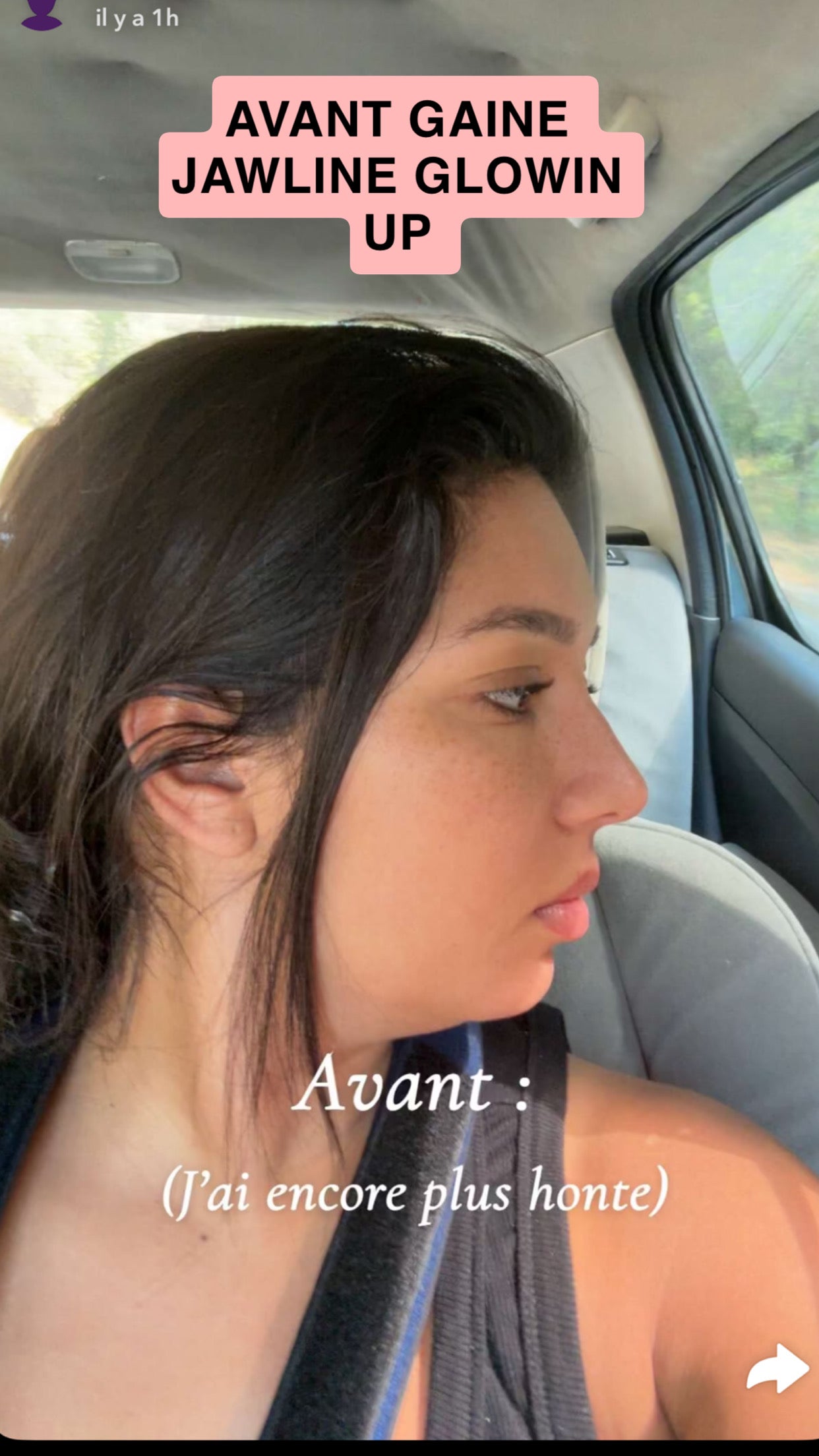 Gaine jawline Glowinup
