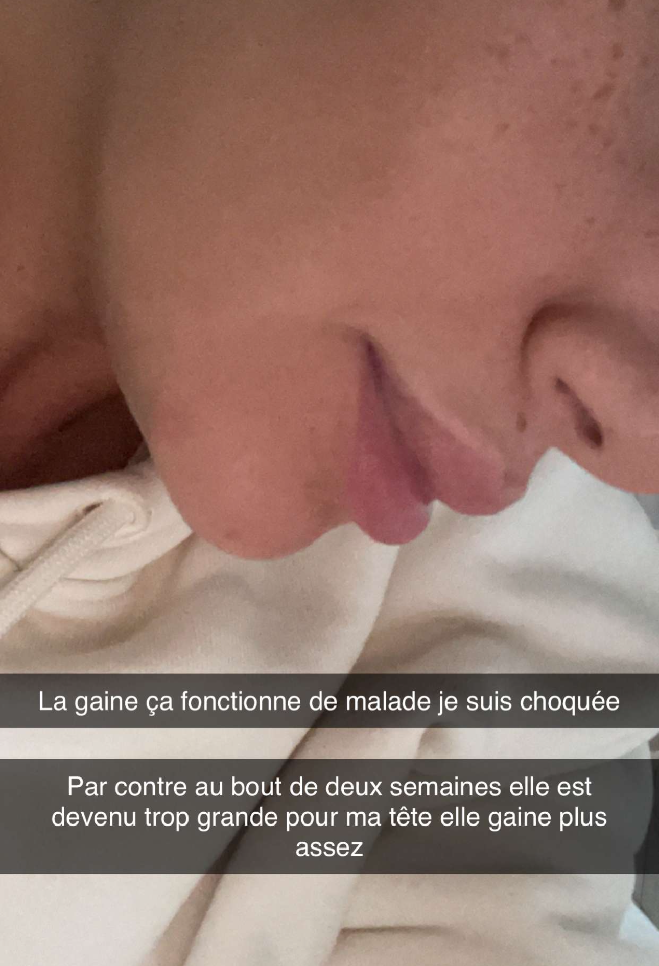 Gaine jawline Glowinup