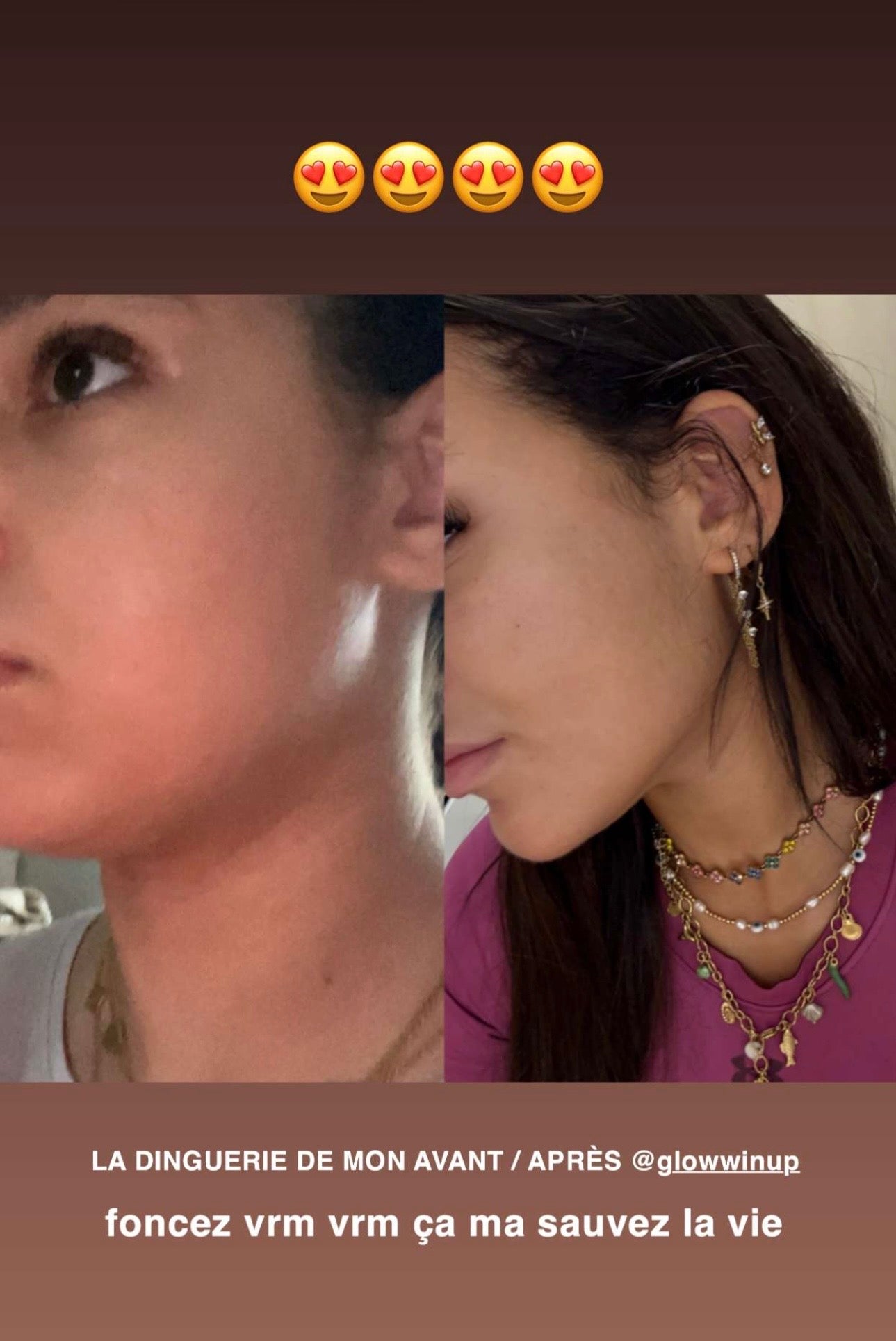 Gaine jawline Glowinup