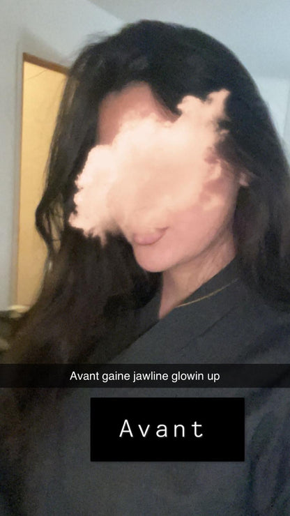 Gaine jawline Glowinup