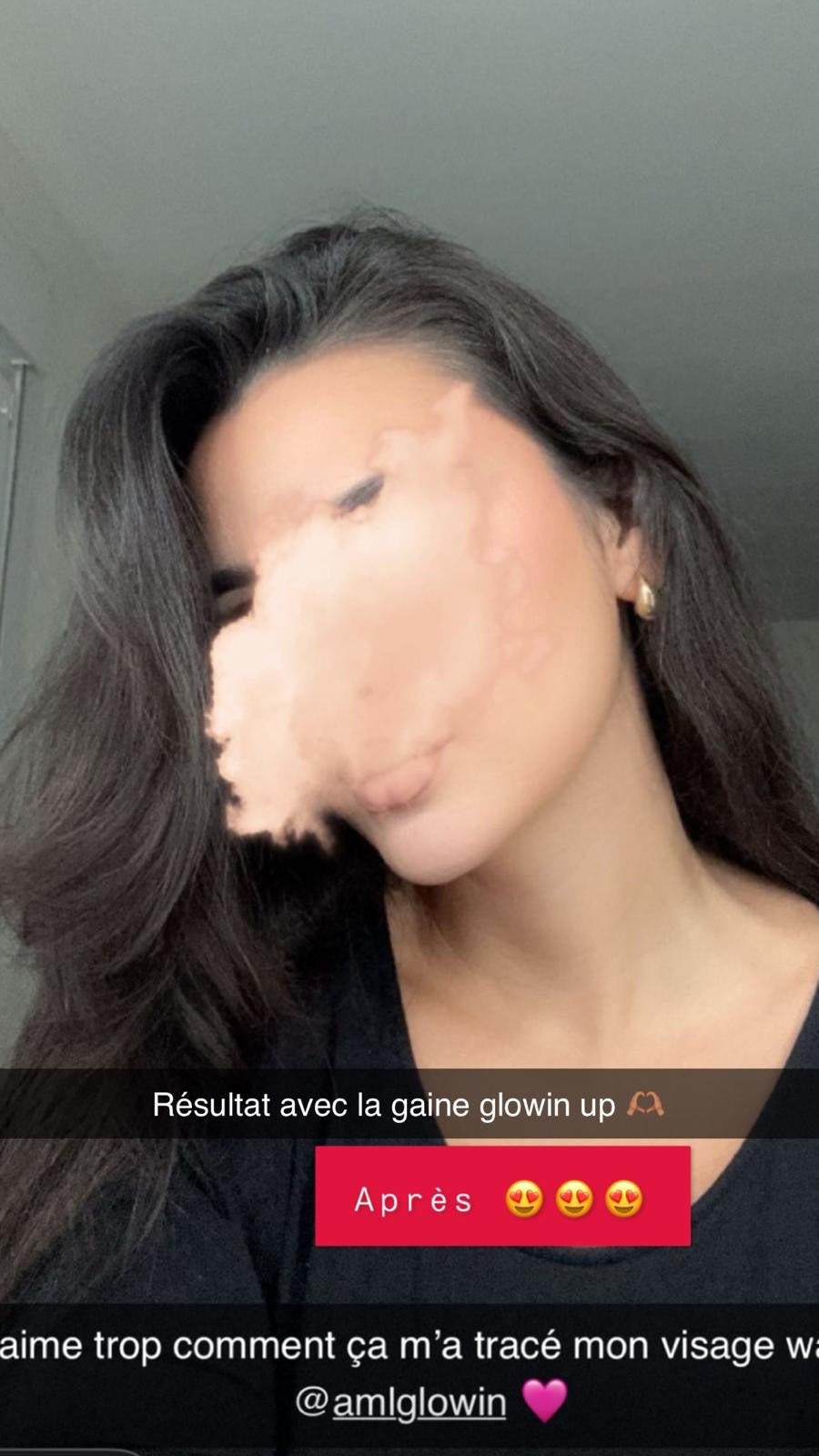 Gaine jawline Glowinup