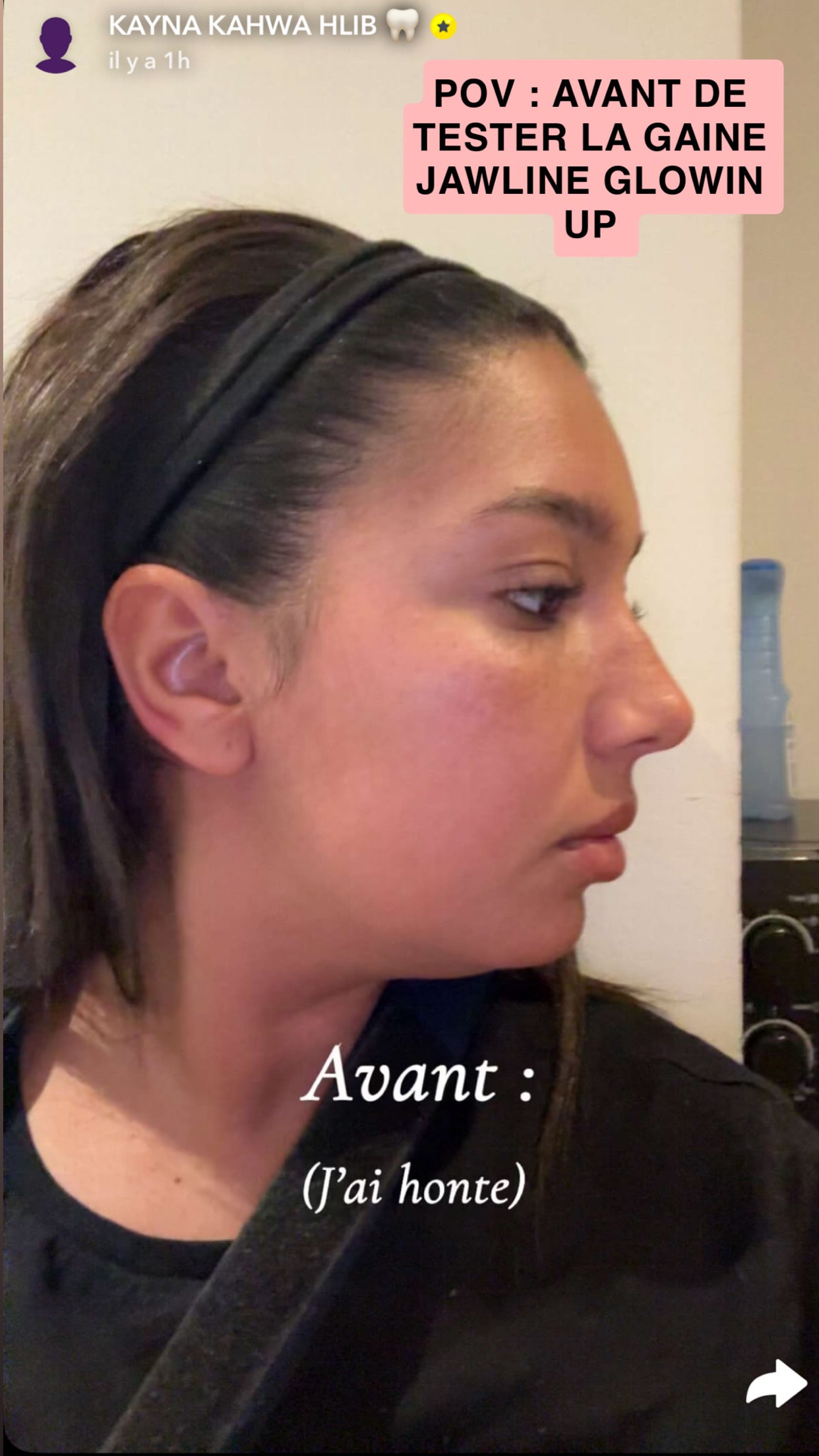 Gaine jawline Glowinup
