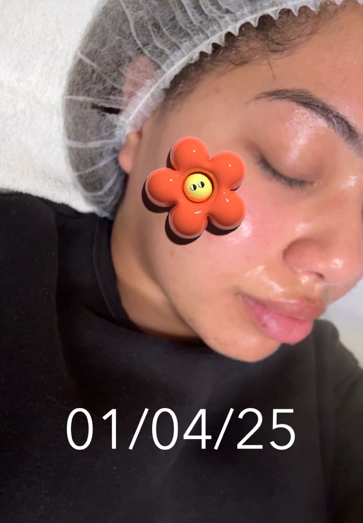 Gaine Jawline Glowinup — Redessinez votre mâchoire