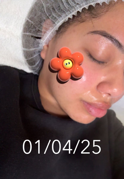 Gaine Jawline Glowinup — Redessinez votre mâchoire