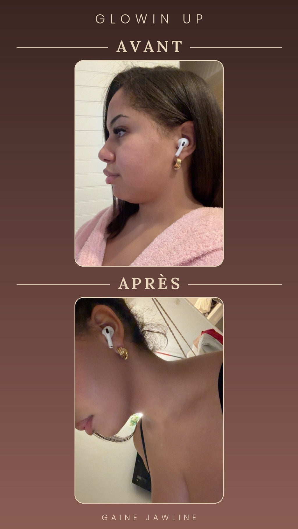 Gaine Jawline Glowinup — Redessinez votre mâchoire