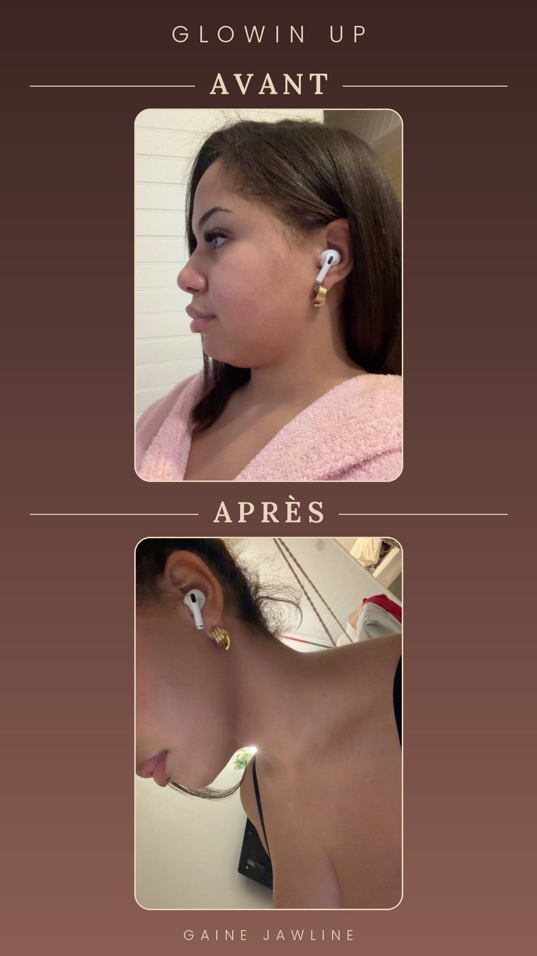 Gaine Jawline Glowinup — Redessinez votre mâchoire