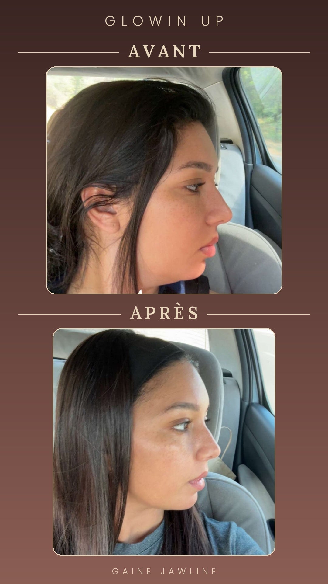Gaine Jawline Glowinup — Redessinez votre mâchoire