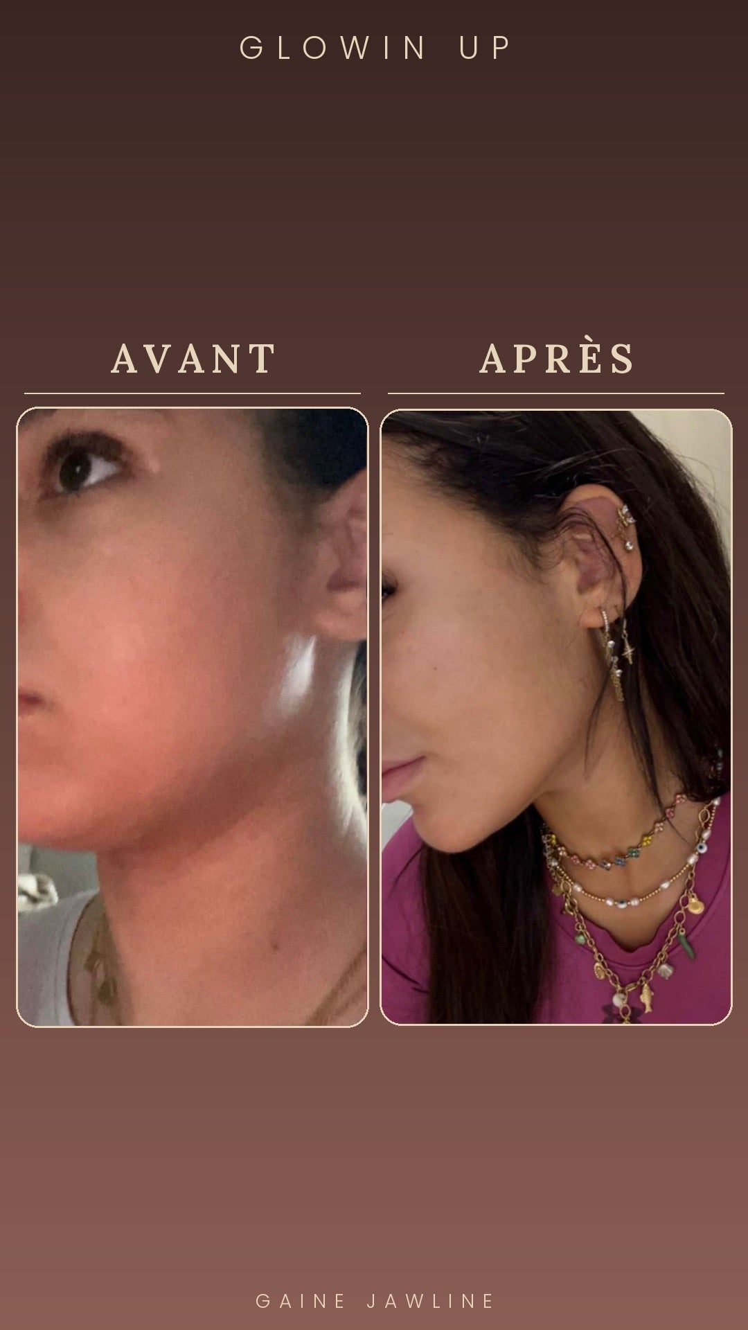 Gaine Jawline Glowinup — Redessinez votre mâchoire