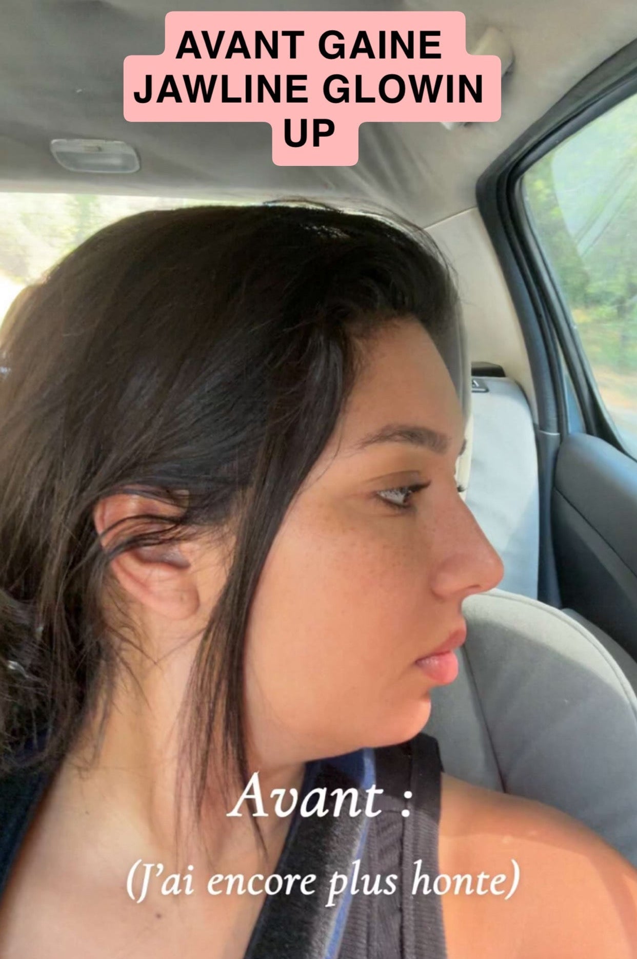 Gaine Jawline Glowinup — Redessinez votre mâchoire