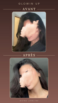 Gaine Jawline Glowinup — Redessinez votre mâchoire