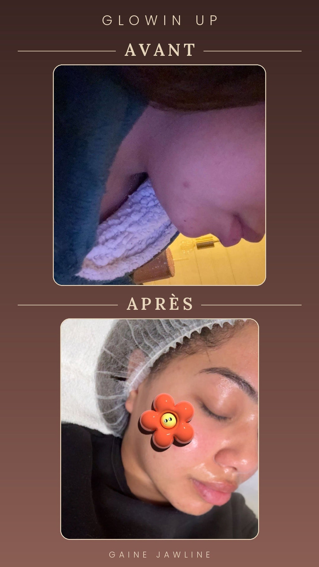 Gaine Jawline Glowinup — Redessinez votre mâchoire