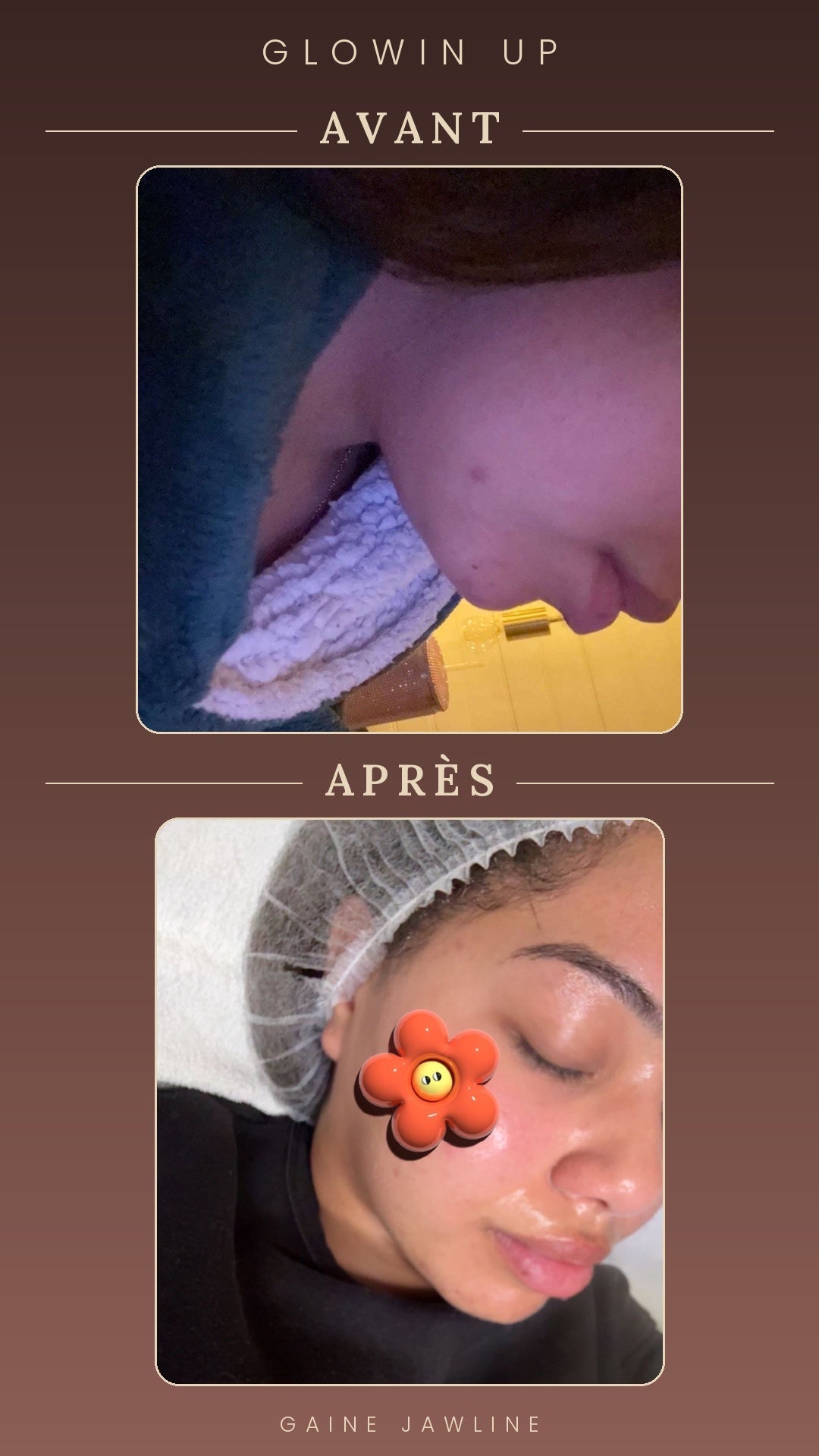 Gaine Jawline Glowinup — Redessinez votre mâchoire
