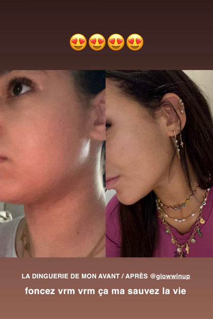 Gaine Jawline Glowinup — Redessinez votre mâchoire