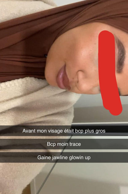 Gaine Jawline Glowinup — Redessinez votre mâchoire