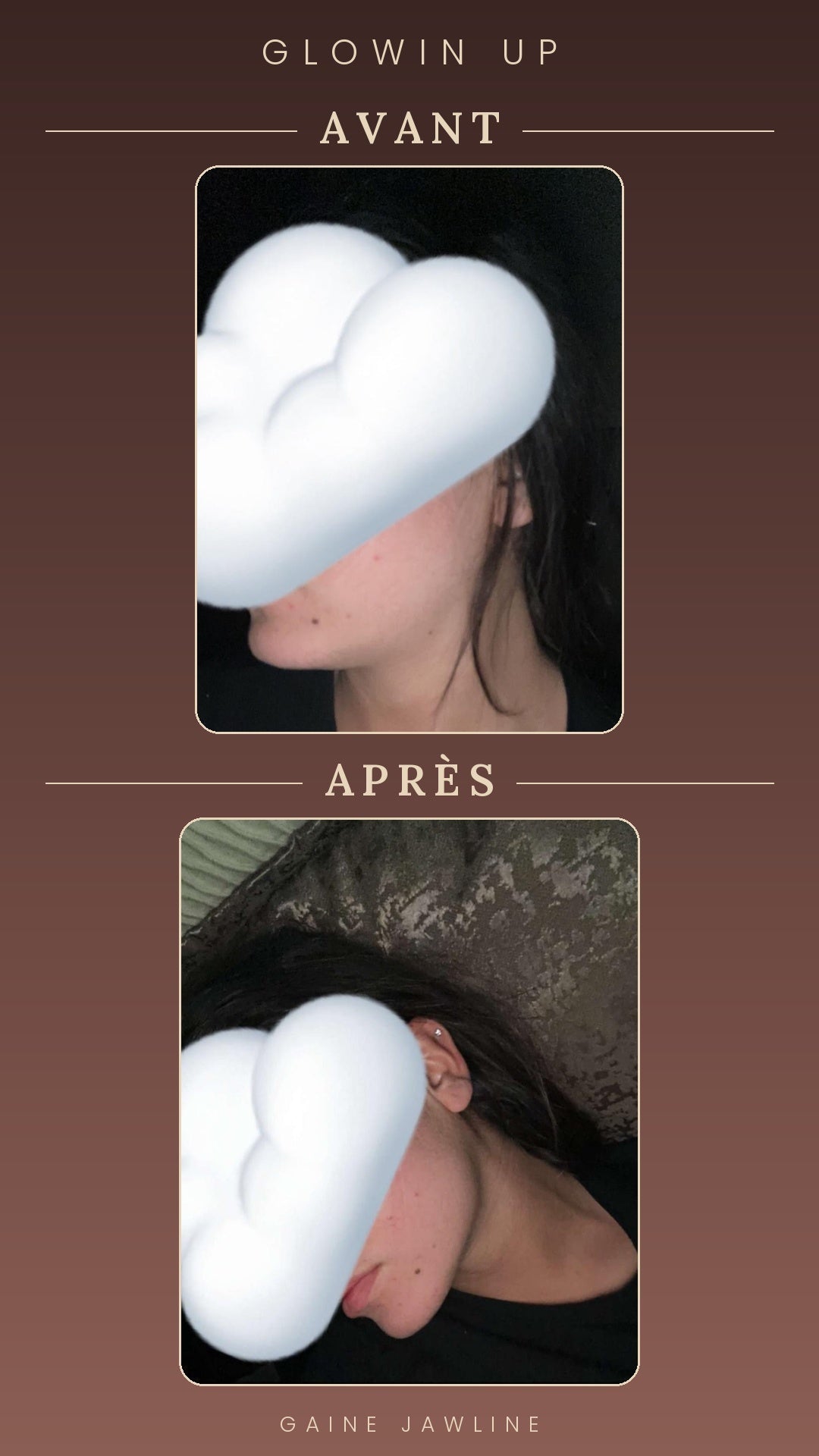 Gaine Jawline Glowinup — Redessinez votre mâchoire
