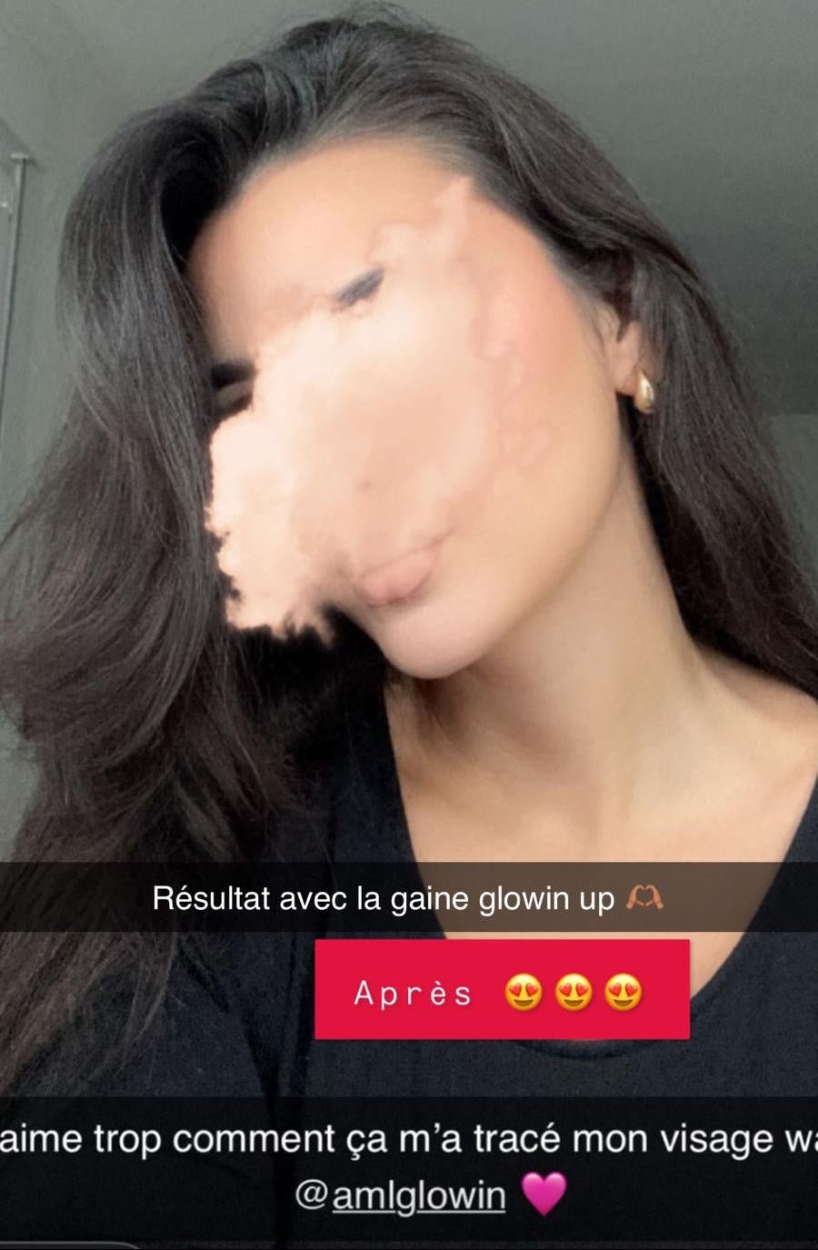Gaine Jawline Glowinup — Redessinez votre mâchoire
