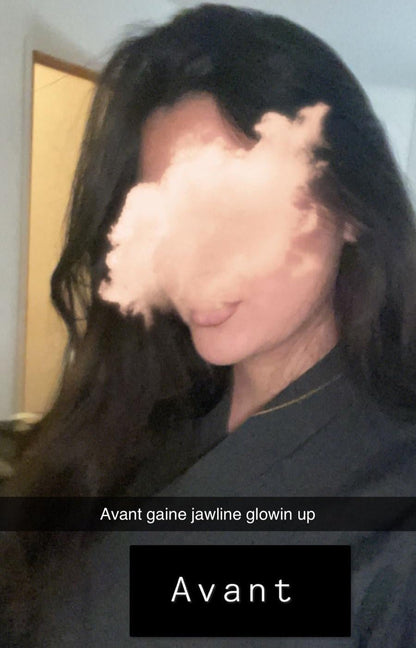 Gaine Jawline Glowinup — Redessinez votre mâchoire