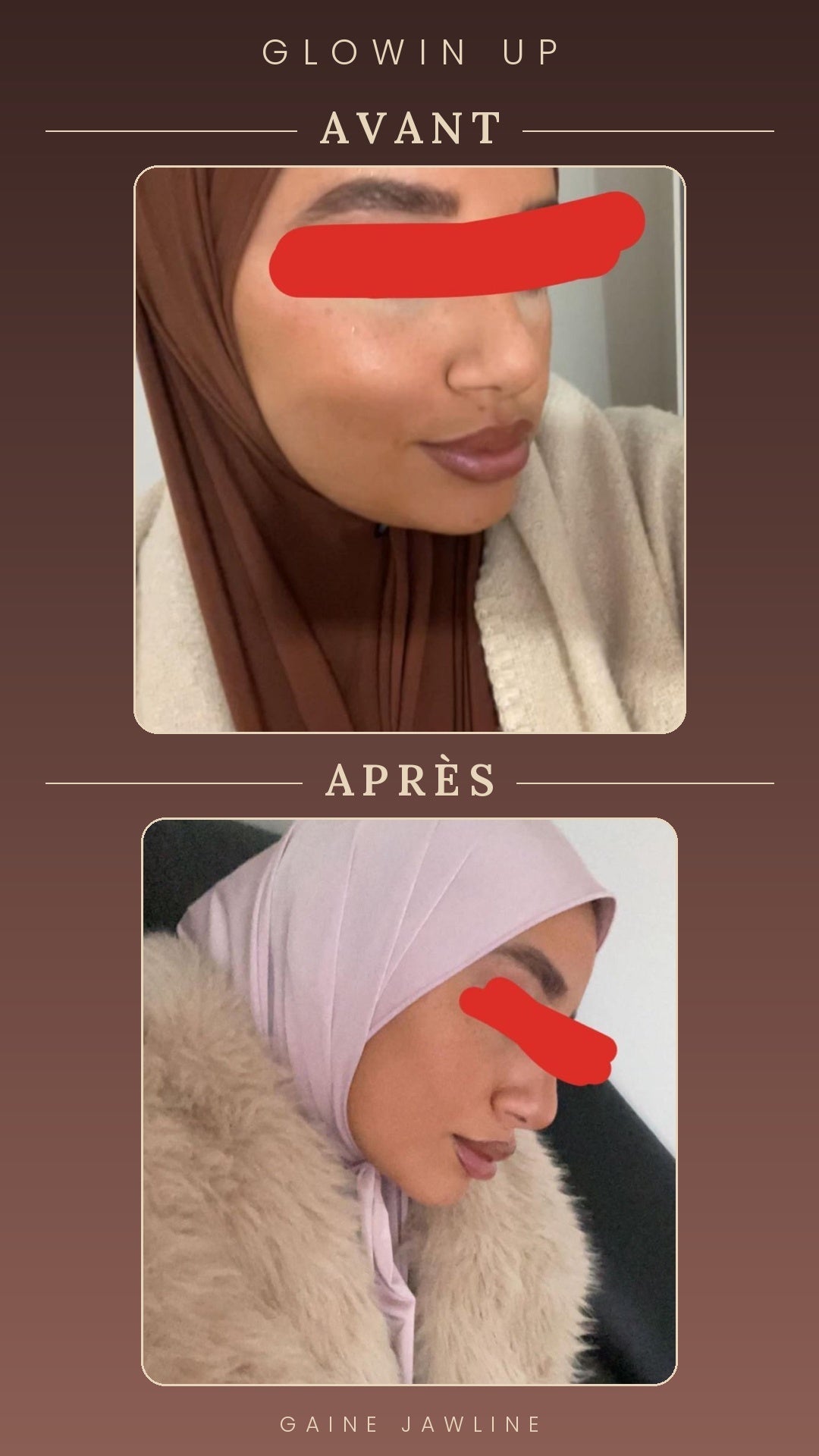 Gaine Jawline Glowinup — Redessinez votre mâchoire