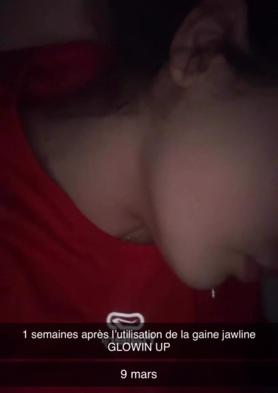Gaine Jawline Glowinup — Redessinez votre mâchoire